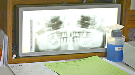 Dental Xray, Brooklyn, NS Dentist